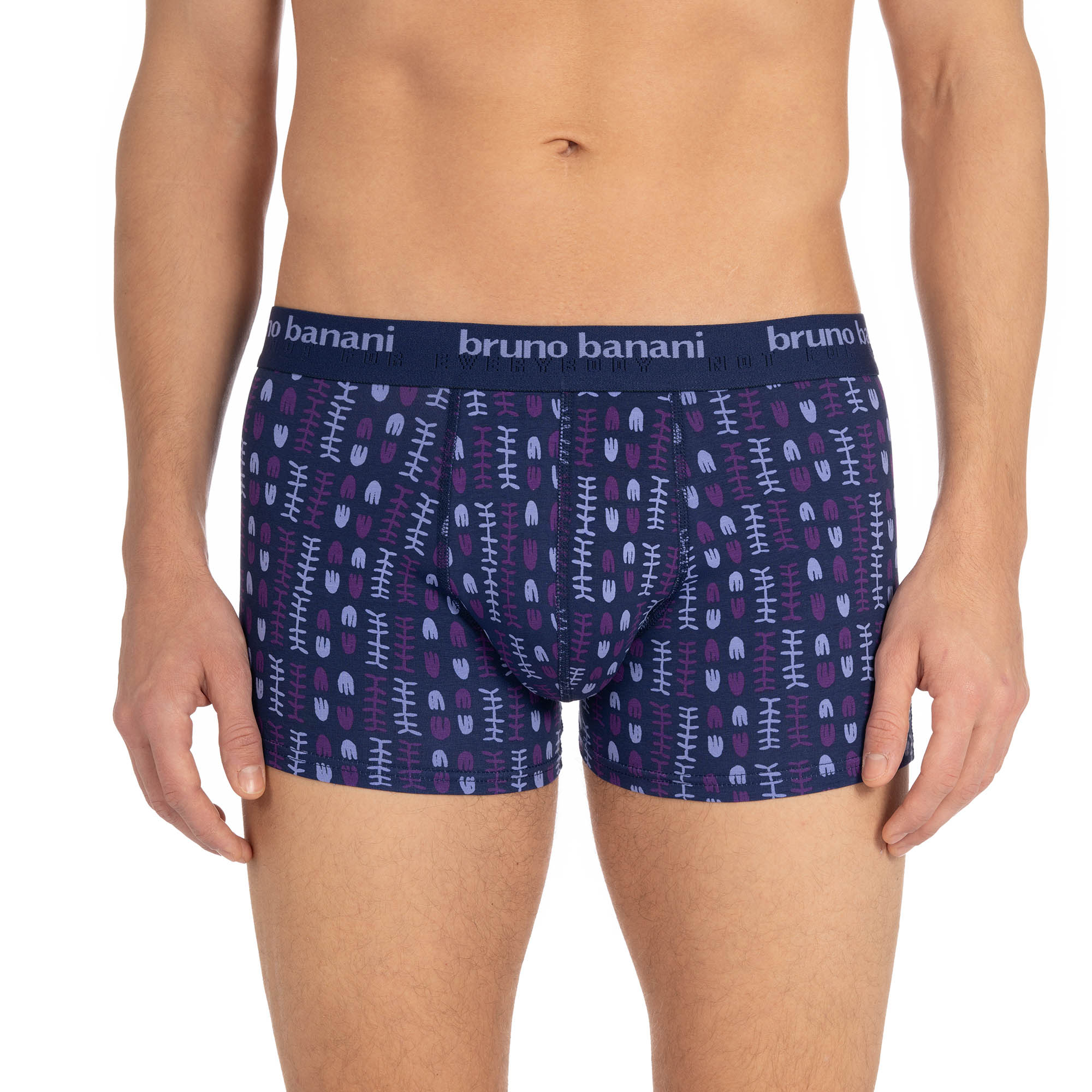 Short print Determination Short print Determination