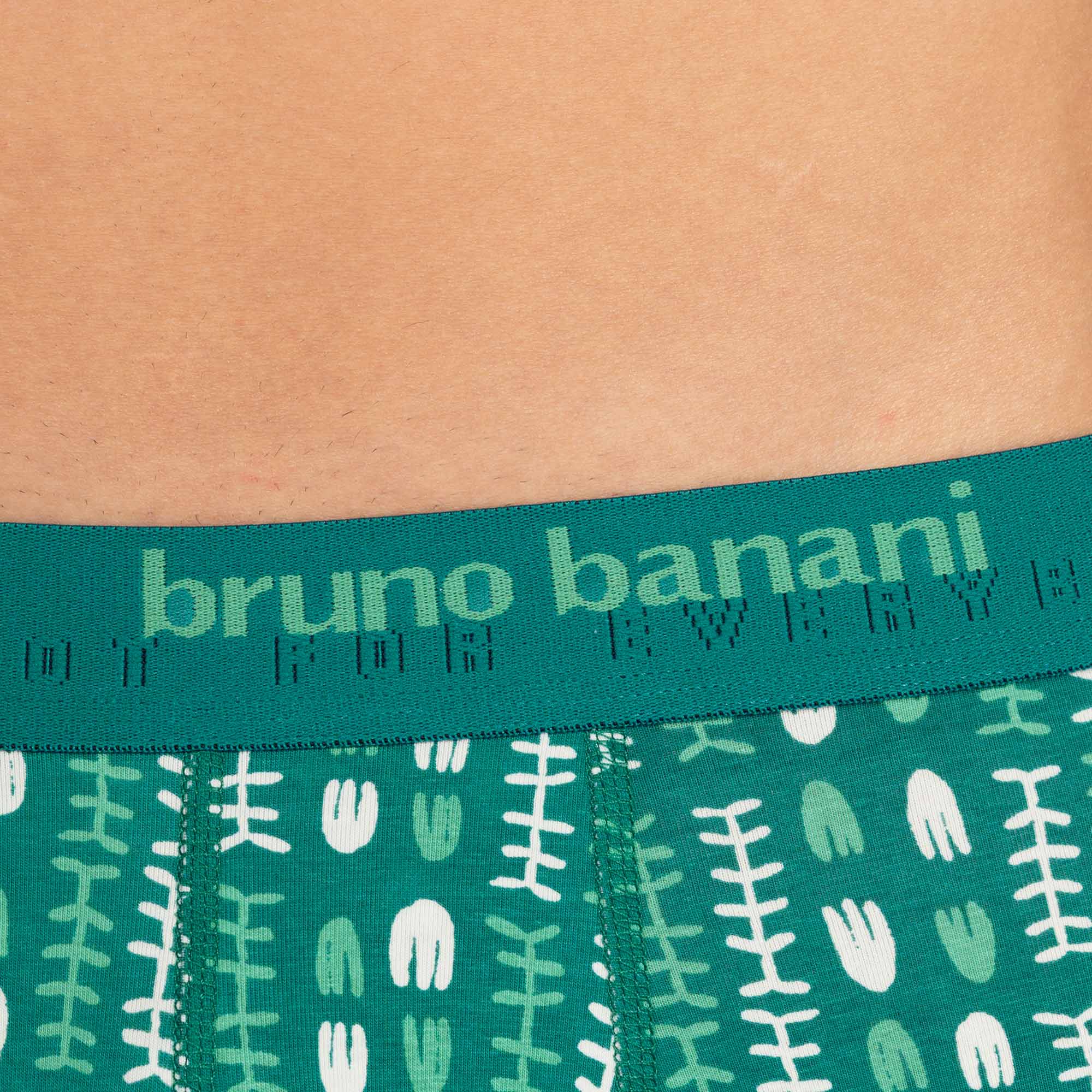 Short print Determination Short print Determination