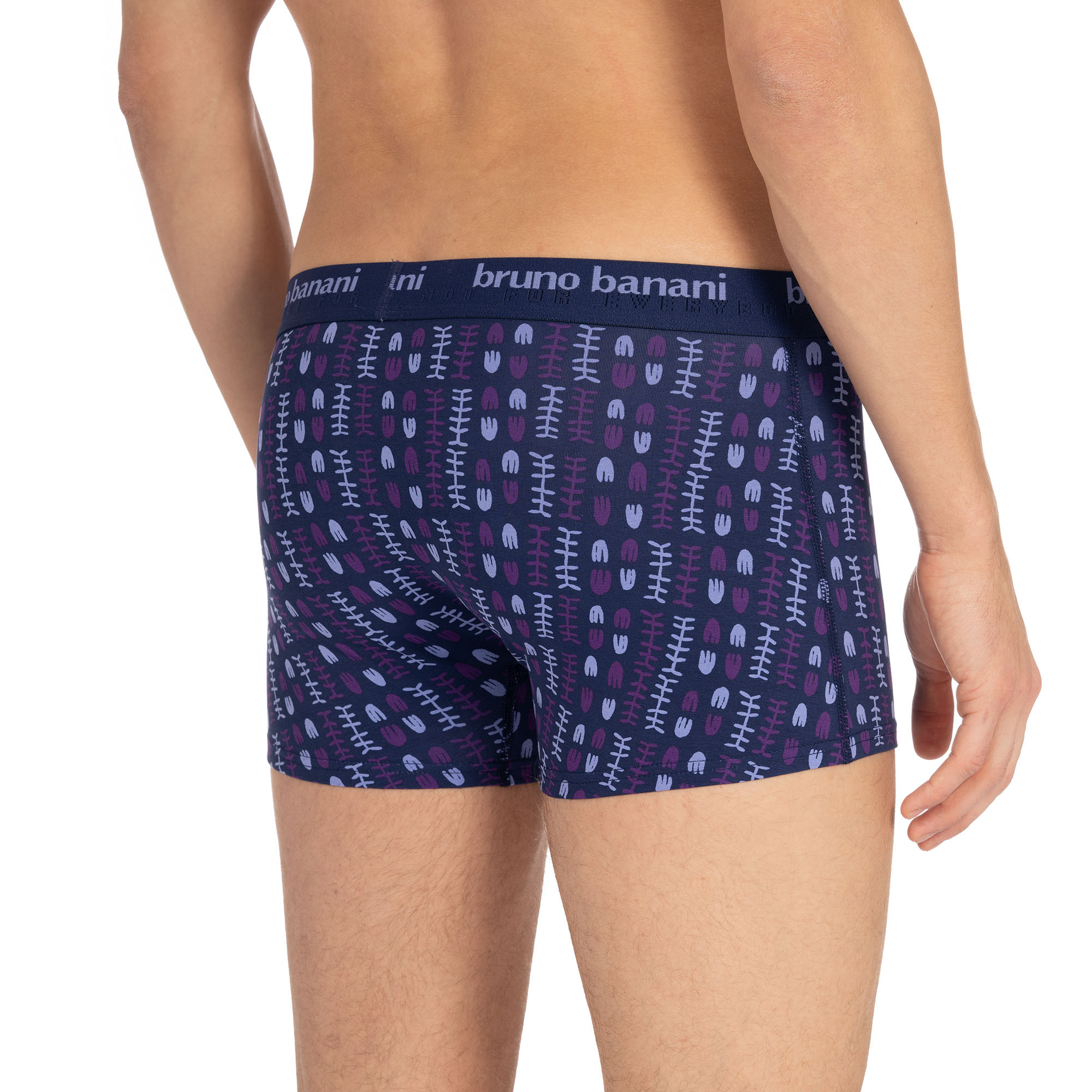 Short print Determination Short print Determination