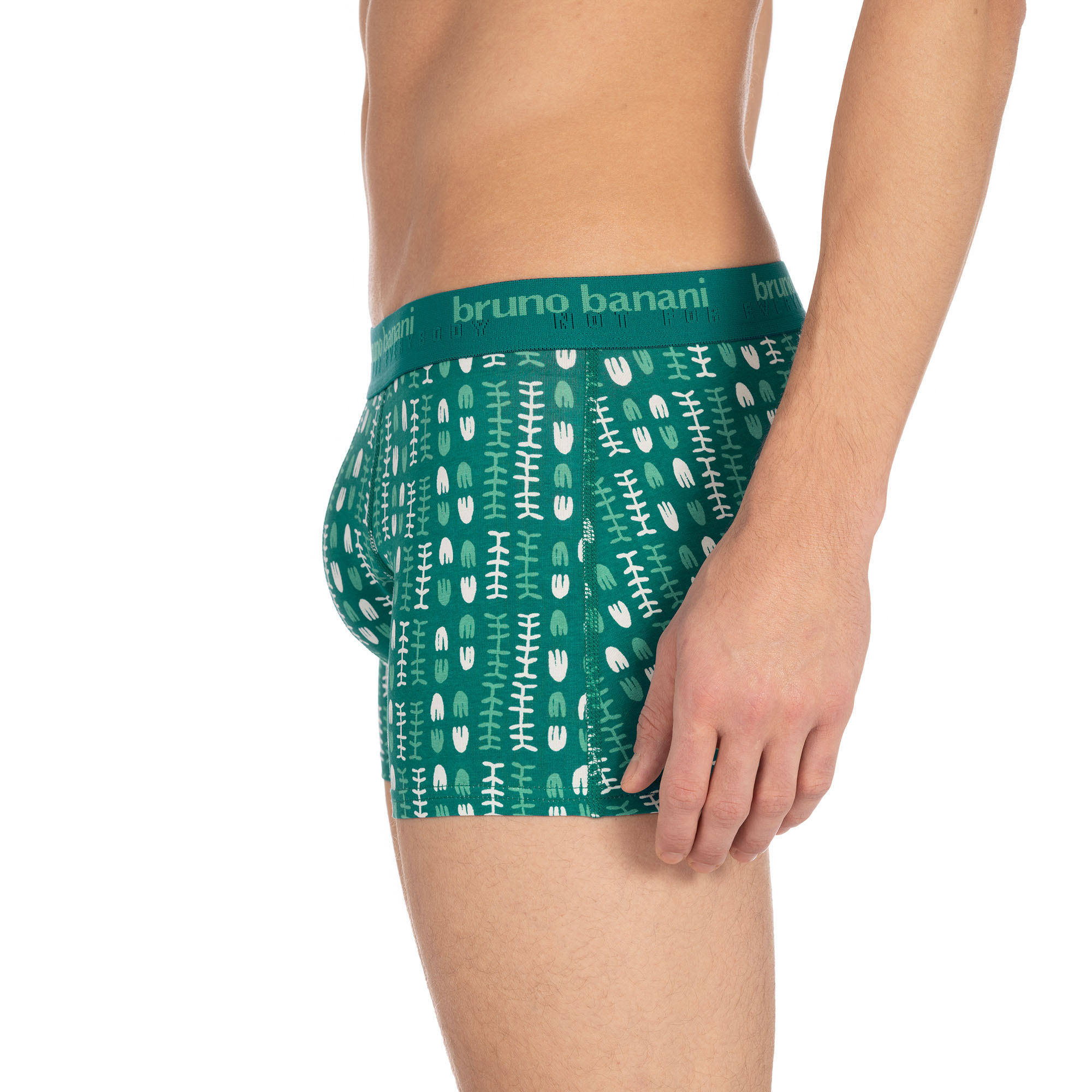 Short print Determination Short print Determination